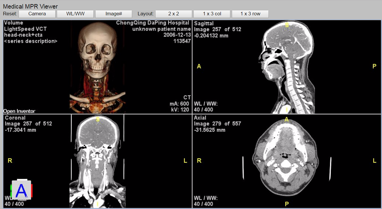 MedicalMPRViewerRemote_b.png