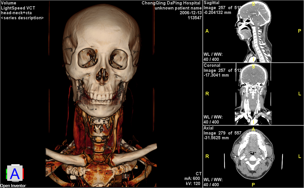 MedicalMPRViewer_c.png