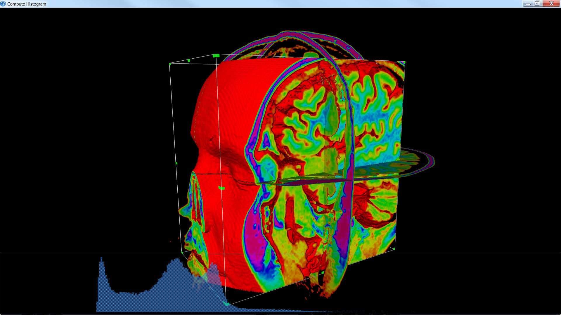 medicalComputeHistogram_b.png