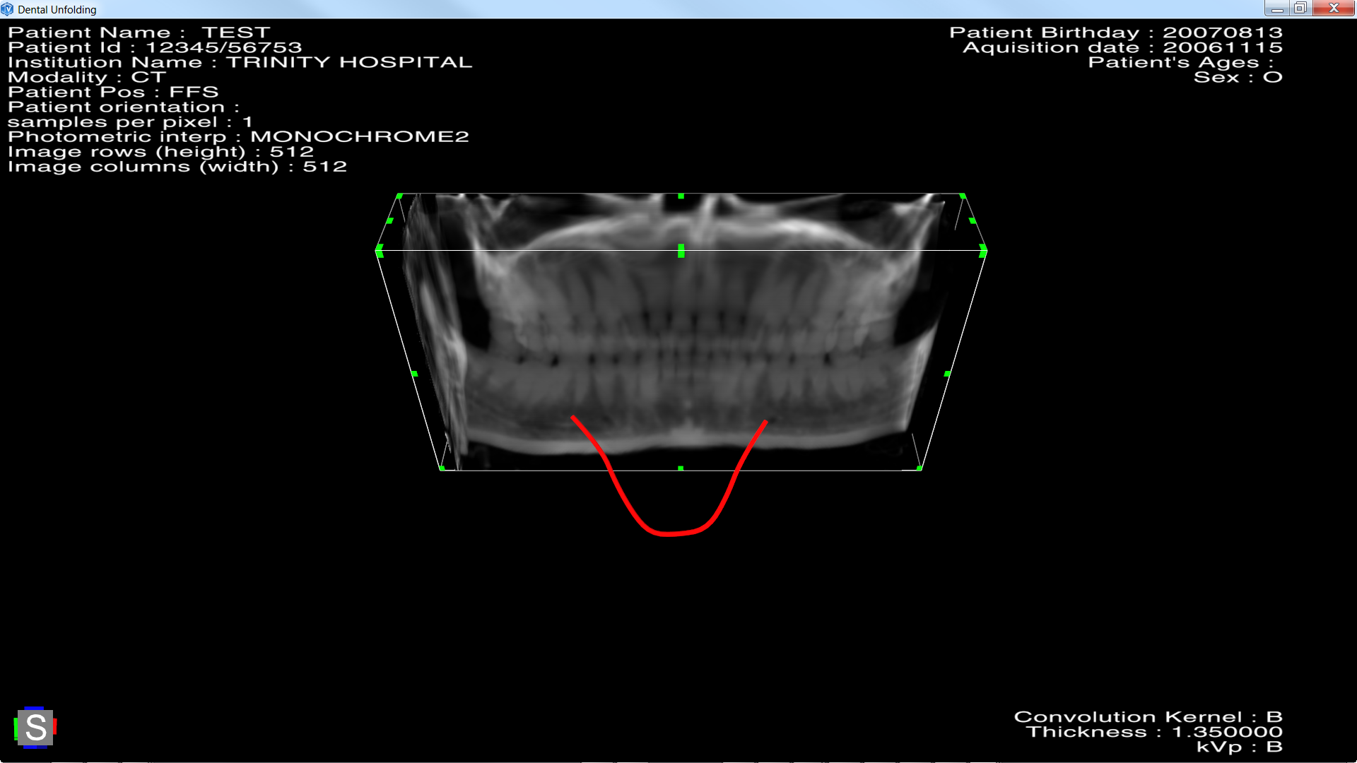 medicalDentalCurveUnfolding_2_b.png