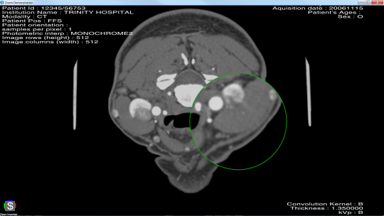 medicalMagnifier.png